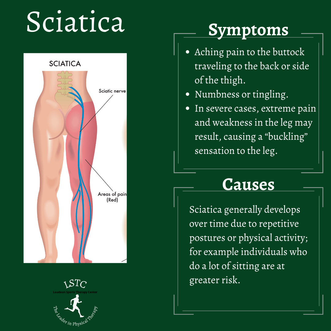 Living With Sciatica Pain Loudoun Sports Therapy Center