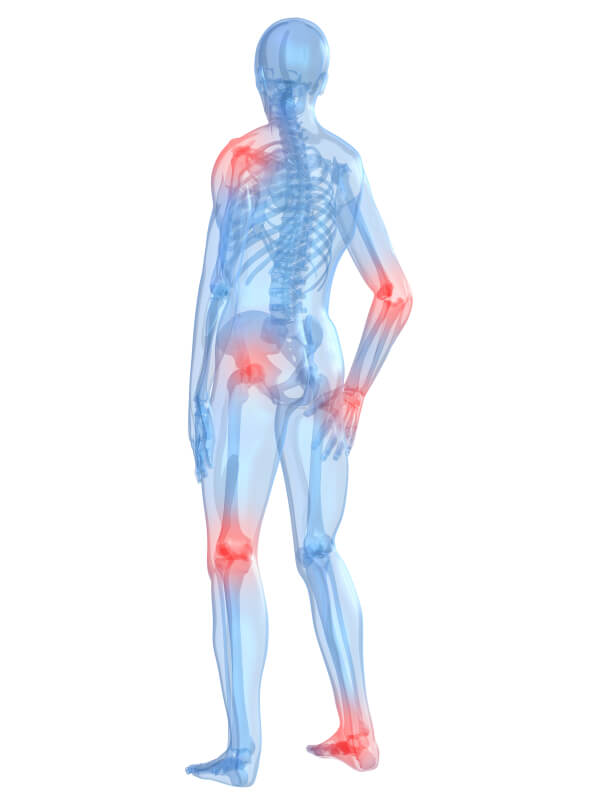 Types of Arthritis and Managing Your Symptoms