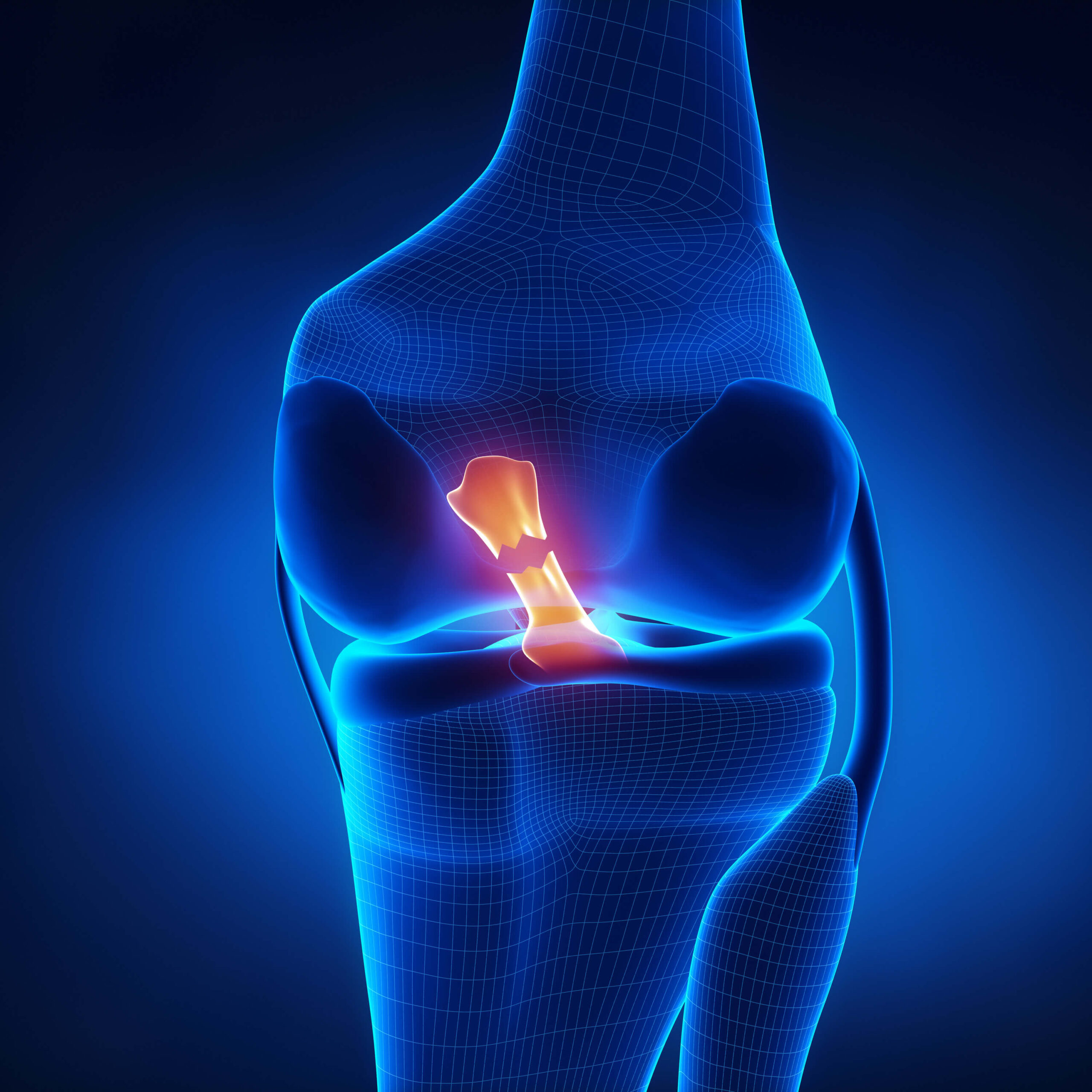 Knee Pain Affects All Ages