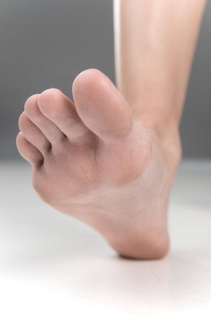 Foot and Arch Discomfort