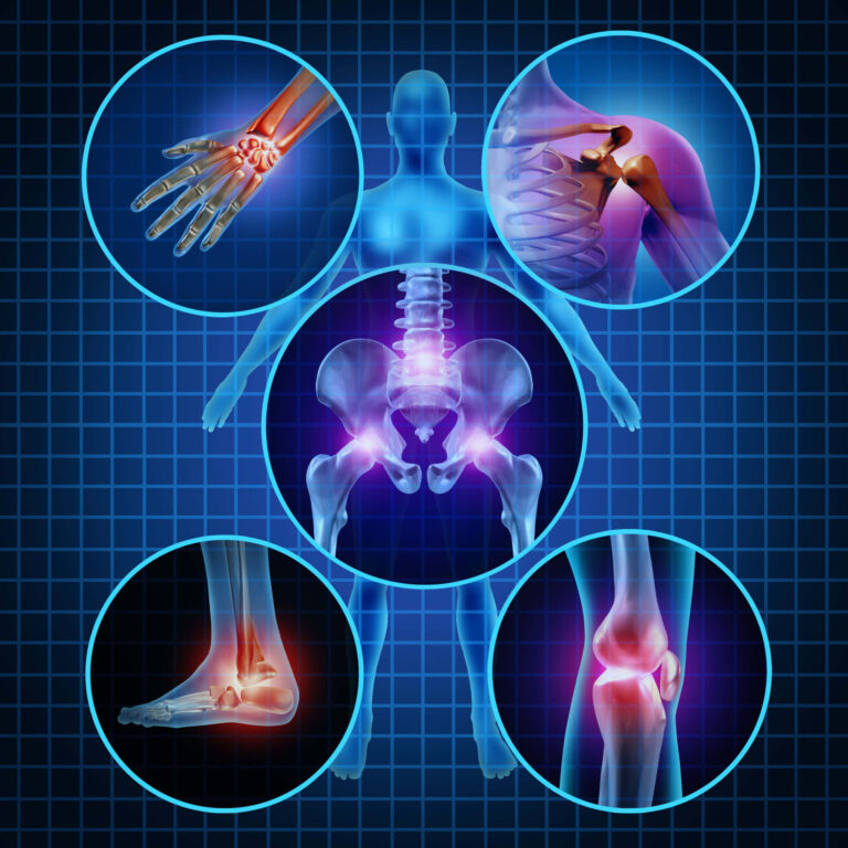 Creaky and Stiff Joints Got You Down?