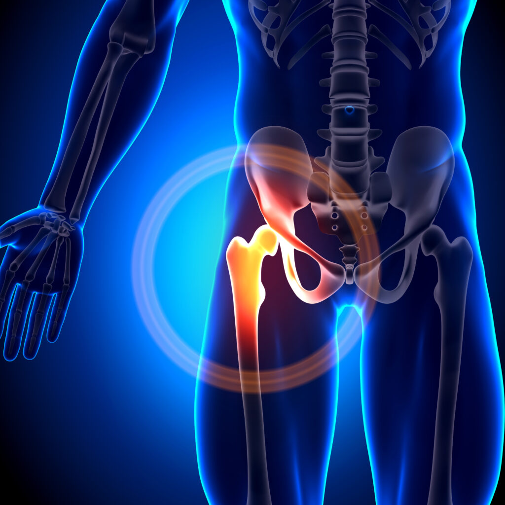 Three Common Sources of Hip Pain