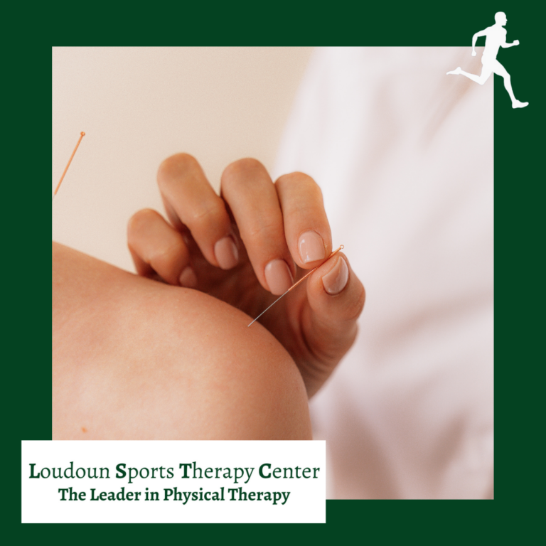 What is Dry Needling?