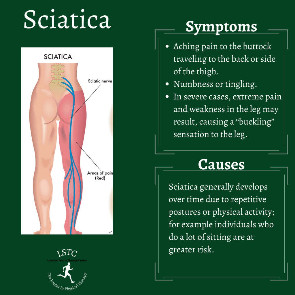 Sciatica: Symptoms and causes of sciatic nerve pain