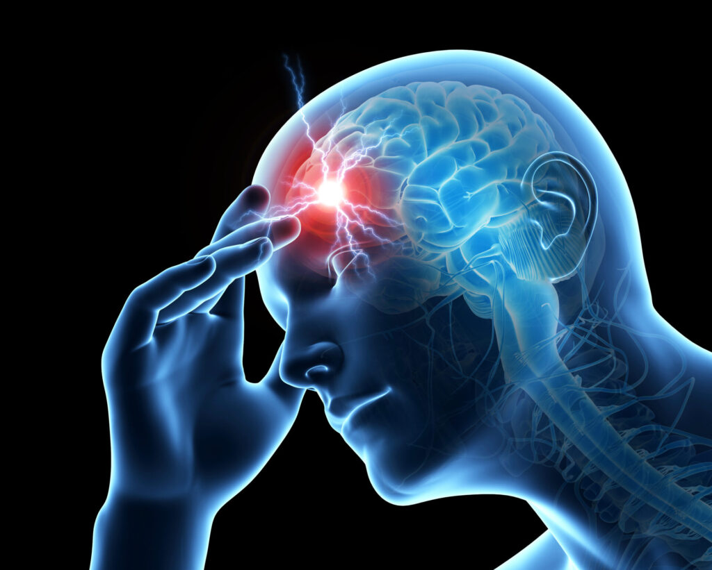 How Physical Therapy can Help with Frequent Headaches